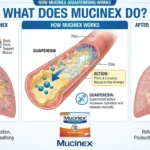 75 what does mucinex do Puns That Clear Up the Laughter what does mucinex do